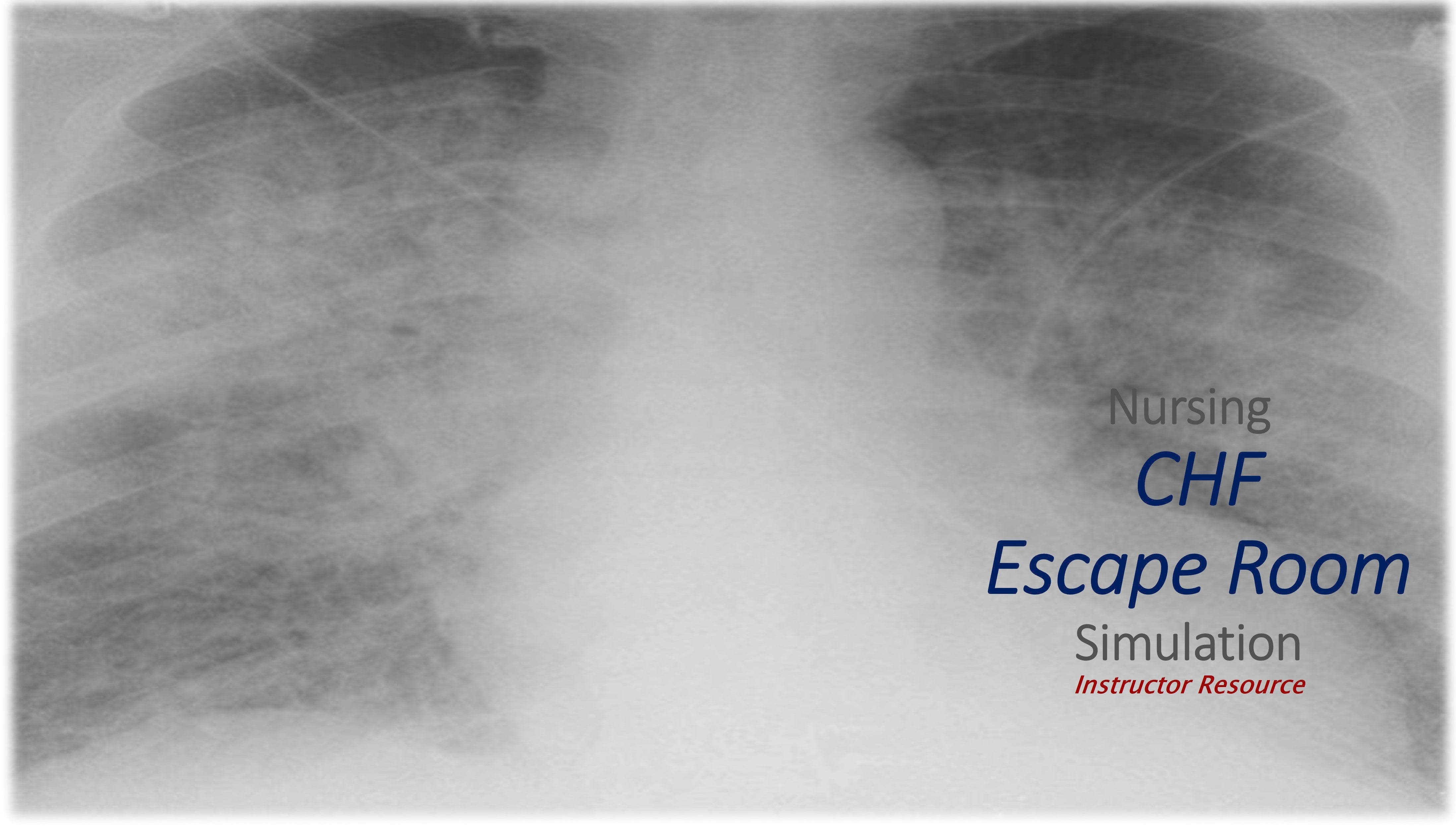 Escape Room Nursing Med/Surg - Congestive Heart Failure